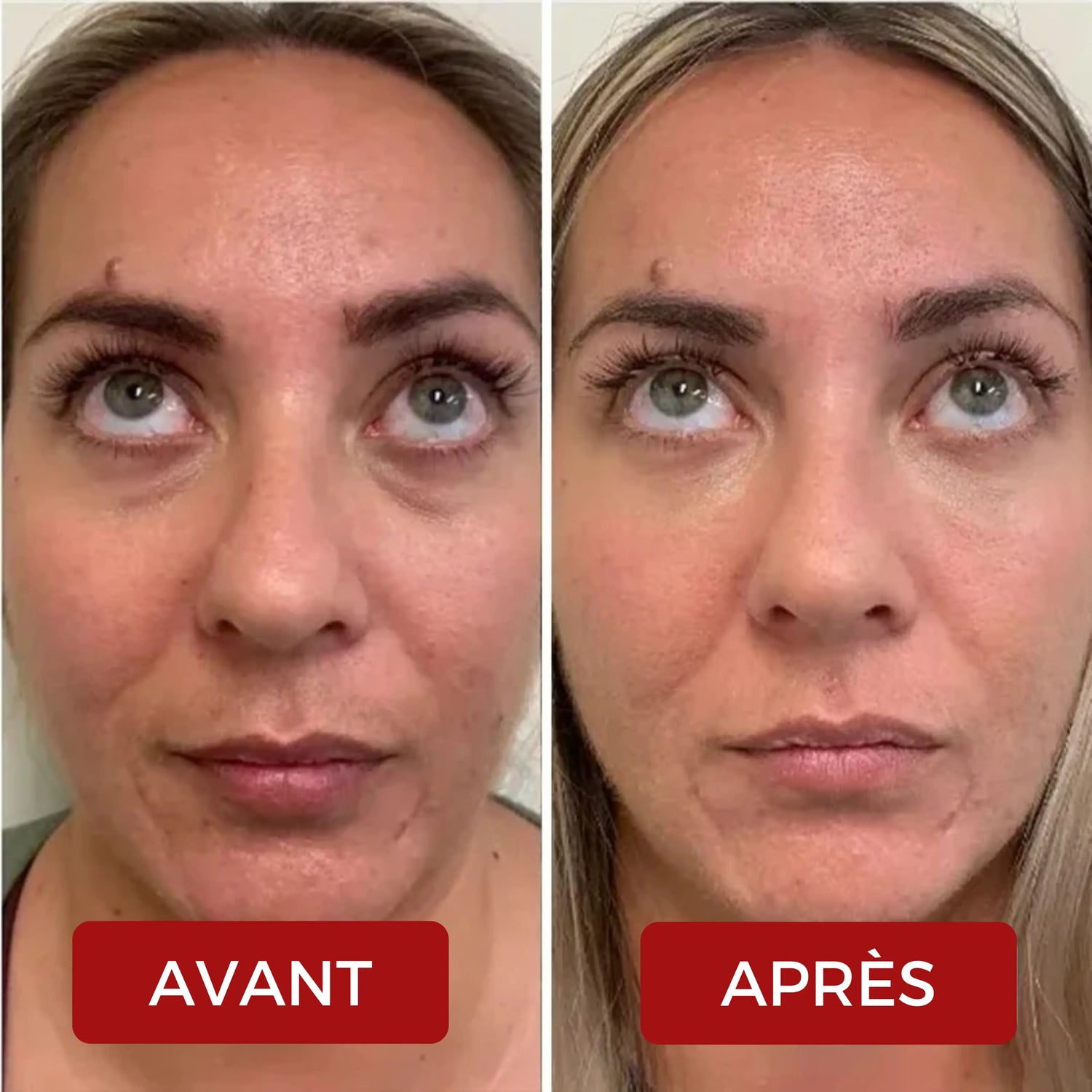 Lumina - Thérapie Lumière Rouge Sous-Oculaire